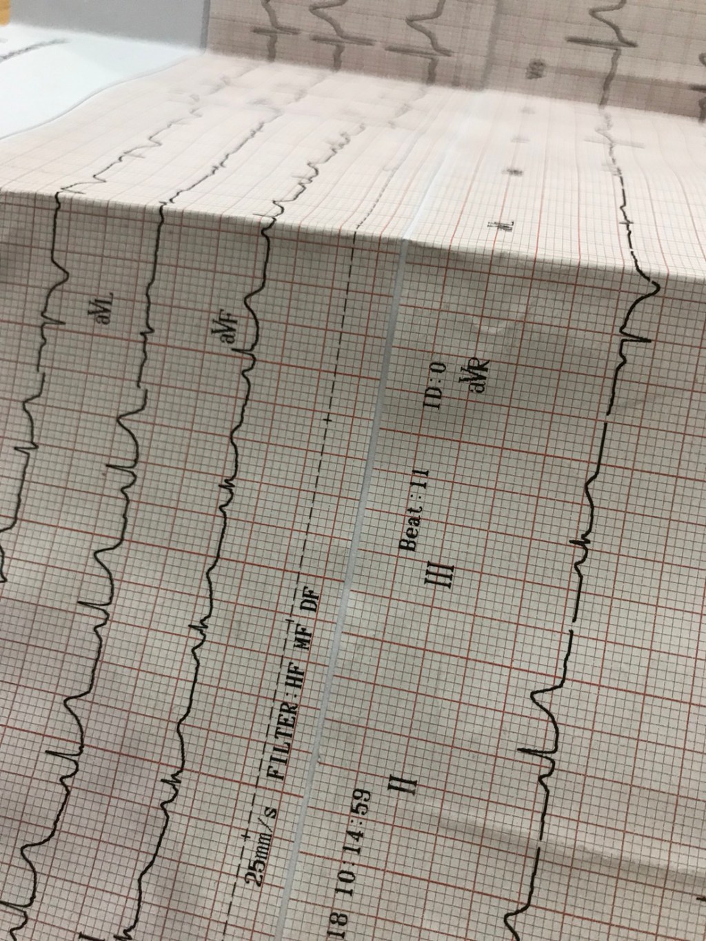 Tak Perlu Takut untuk Memeriksakan&nbsp;Diri